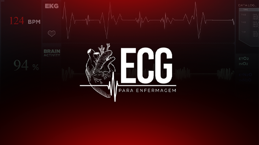 ECG